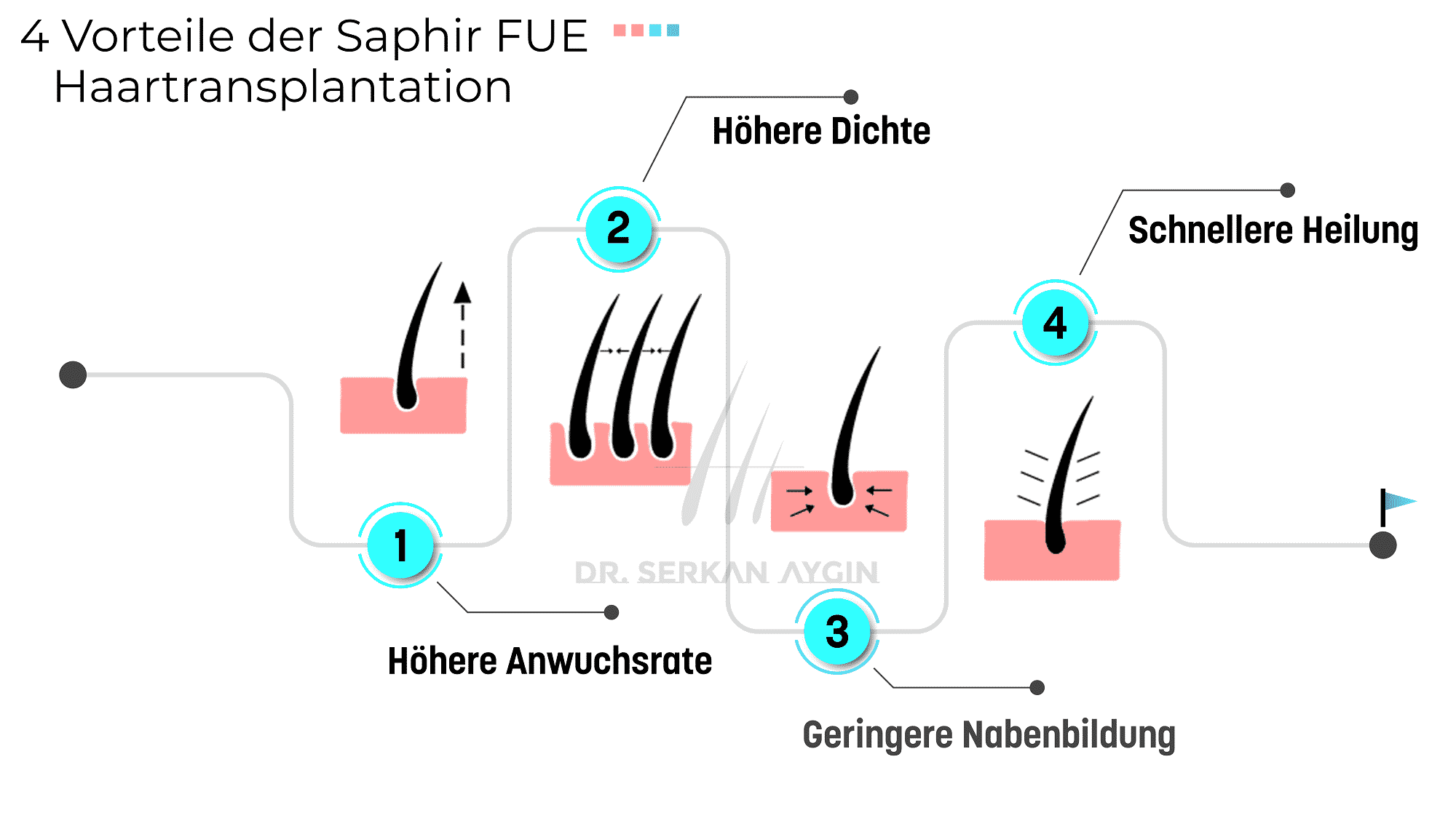 Saphir FUE Haartransplantation_Vorteile