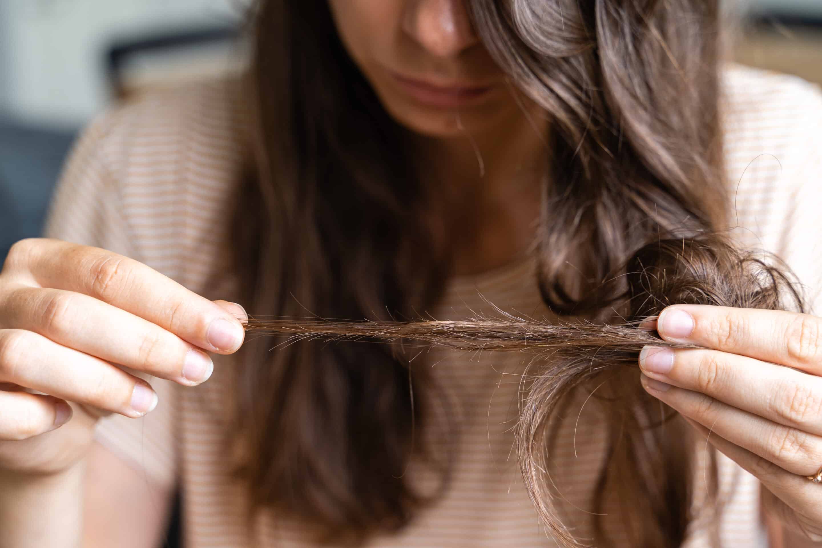 Eine Frau betrachtet Ihre von Haarausfall betroffenen Haare, die durch die Veränderungen ihrer Hormone verursacht werden