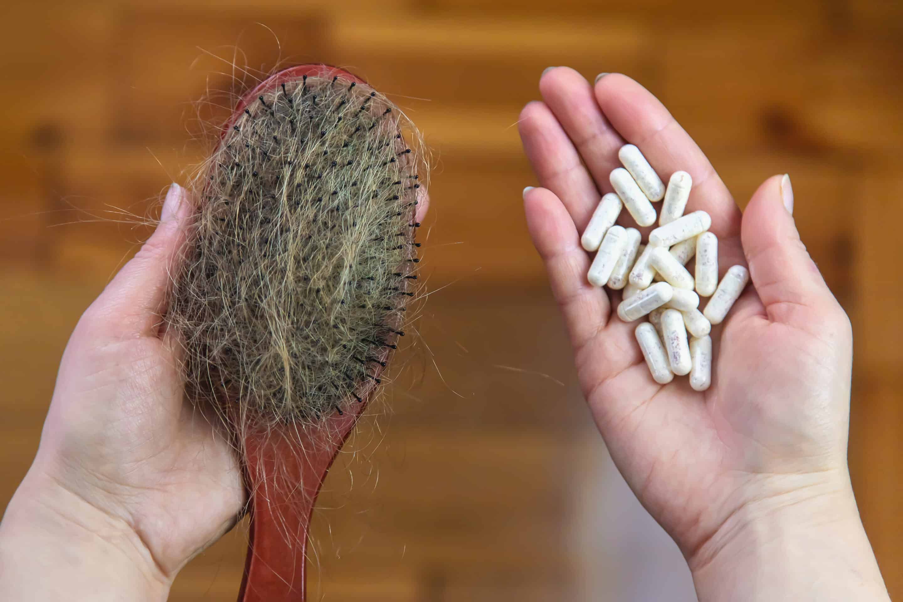 Eine Frau, die ihr Haarausfall vorbeugen möchte, hält Vitamine in ihrer Hand