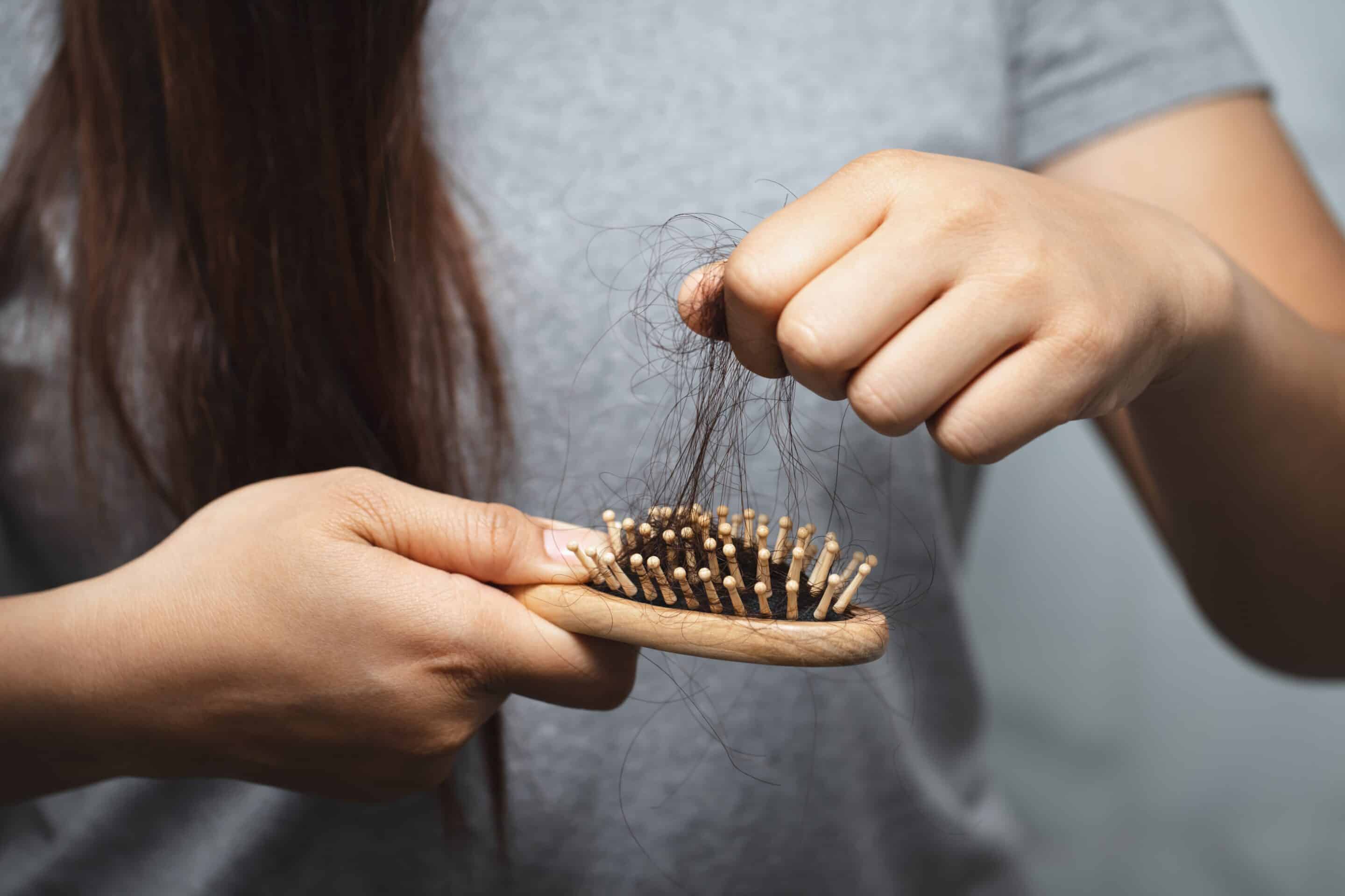 Eine Frau mit Haarausfall durch Vitaminmangel, entfernt ihre Haare von einer Bürste.